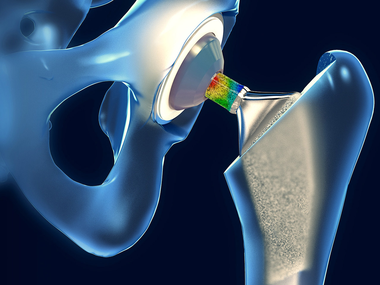 Analiza właściwości mechanicznych implantu biodrowego