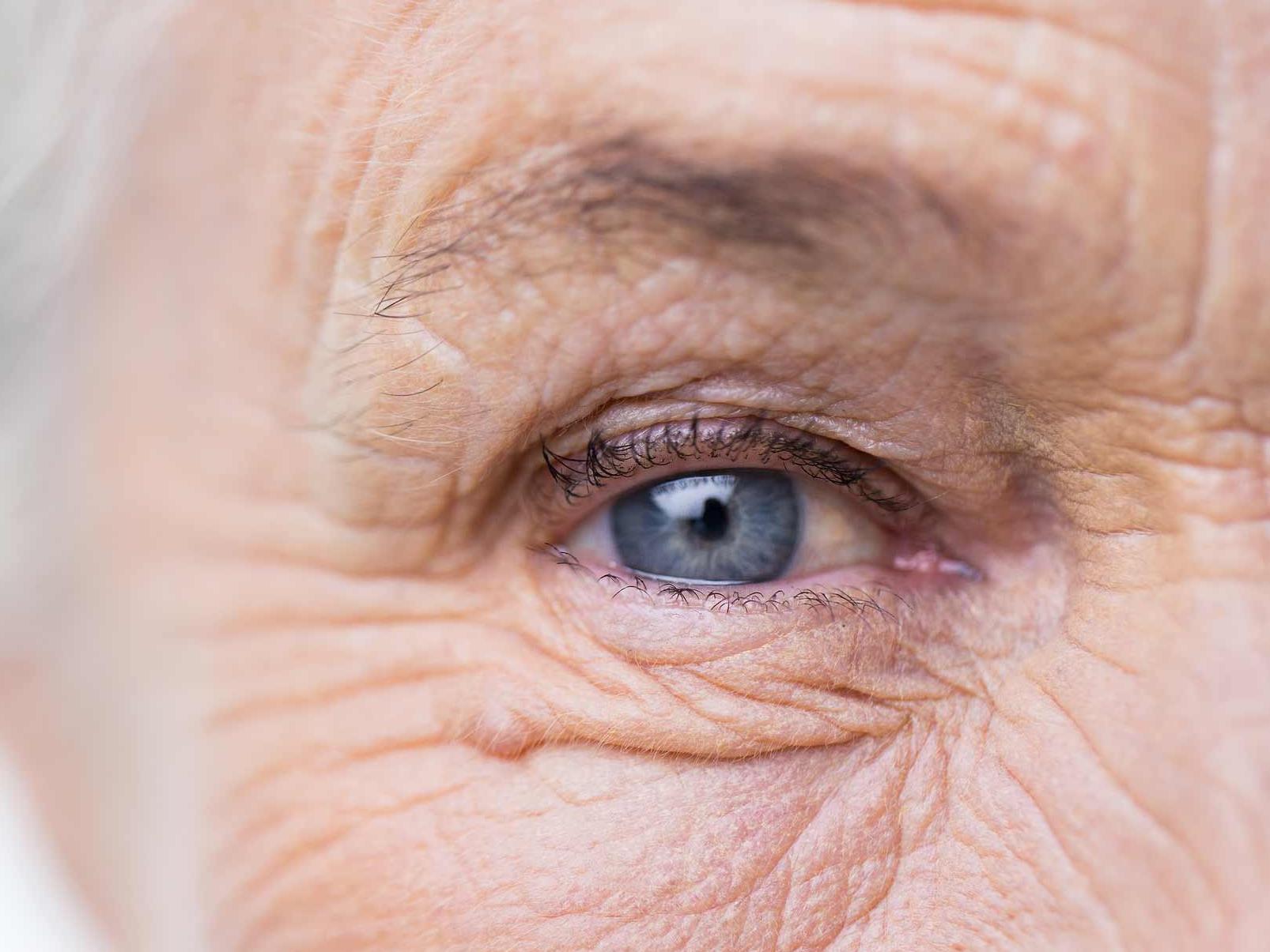 Obraz przedstawia zbliżenie niezdrowego oka, ilustrujące potencjalne zagrożenia dla przydatków oka. 