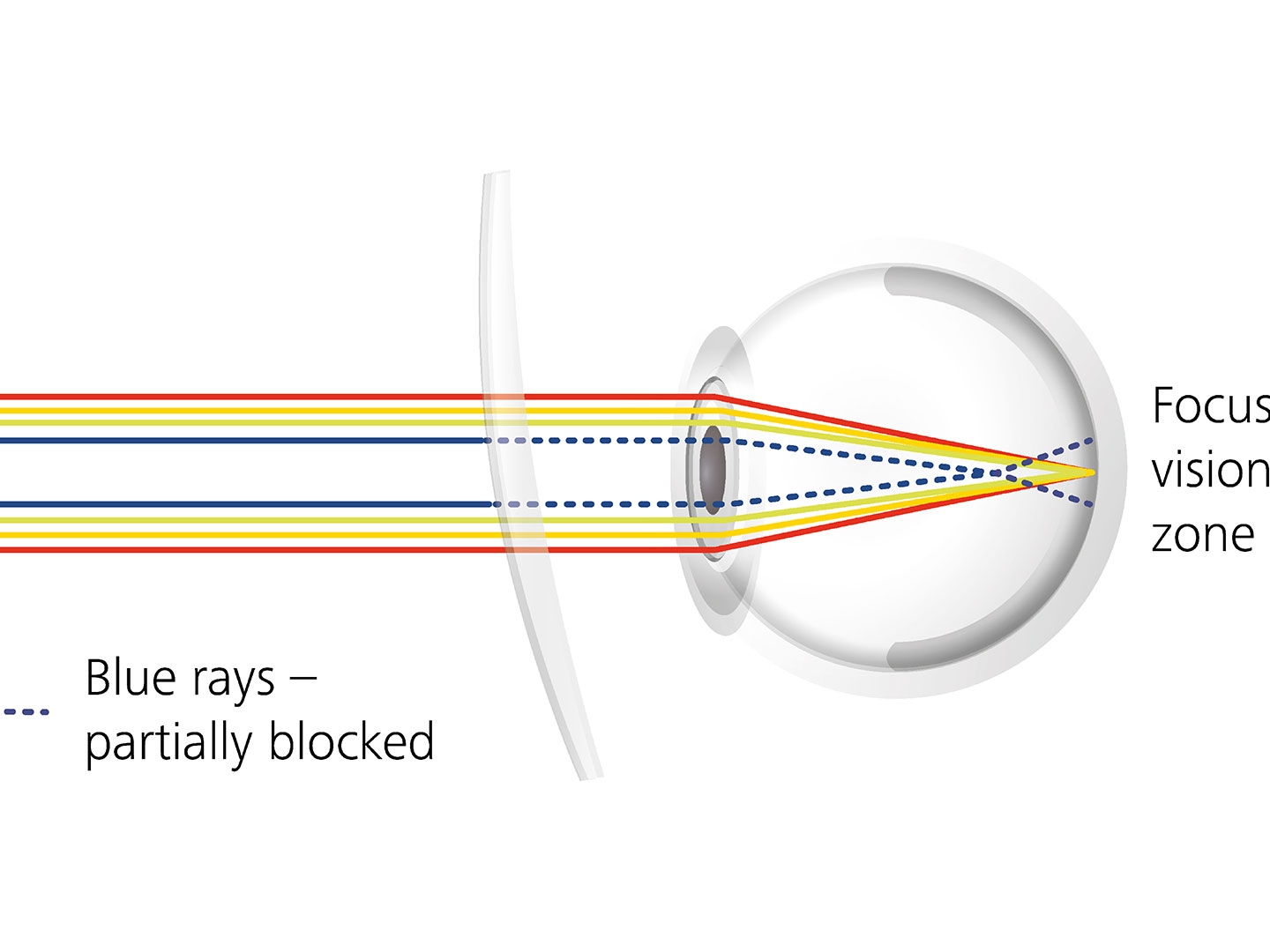 Wizualizacja tego, jak powłoki soczewek mogą redukować odblaski poprzez częściowe blokowanie niebieskiego promieniowania 